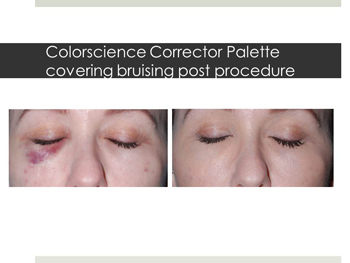 Before and after Colorscience Corrector Palette results