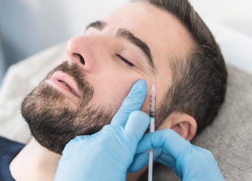 Male Botox treatment