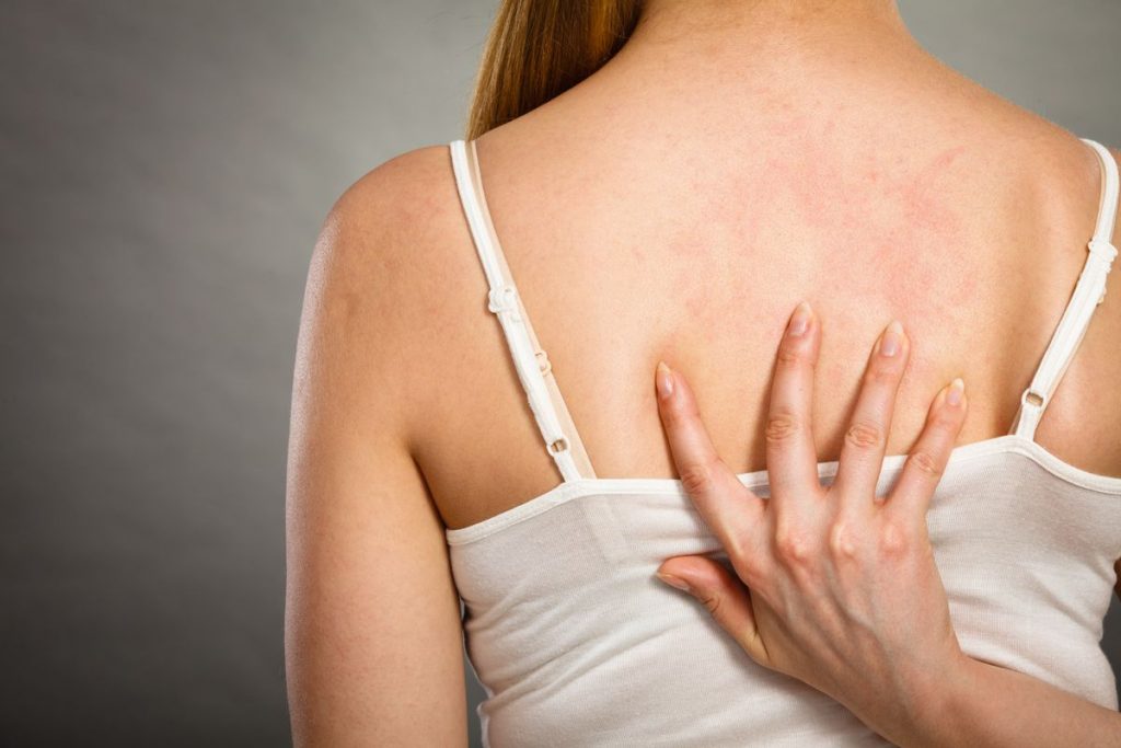 Woman scratching her back