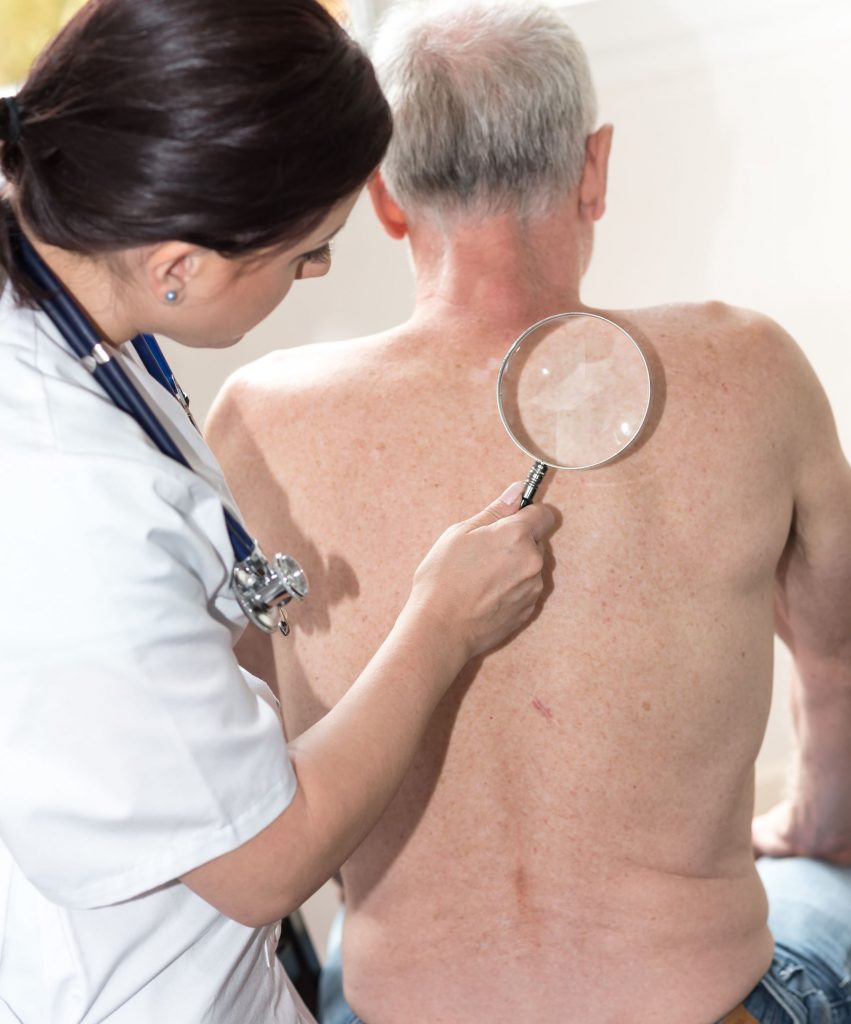 Doctor checking skin of senior patient