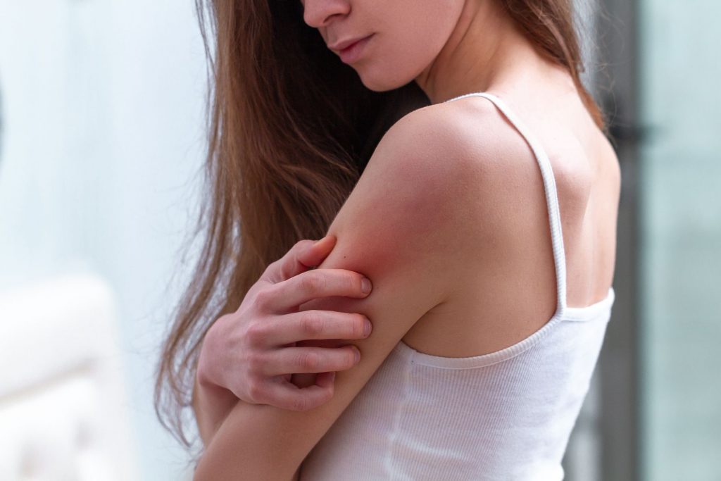 Woman scratching her arm