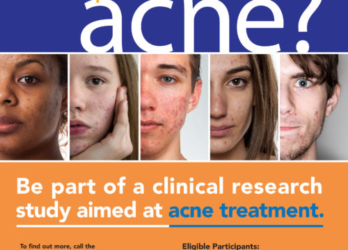 Acne Trial