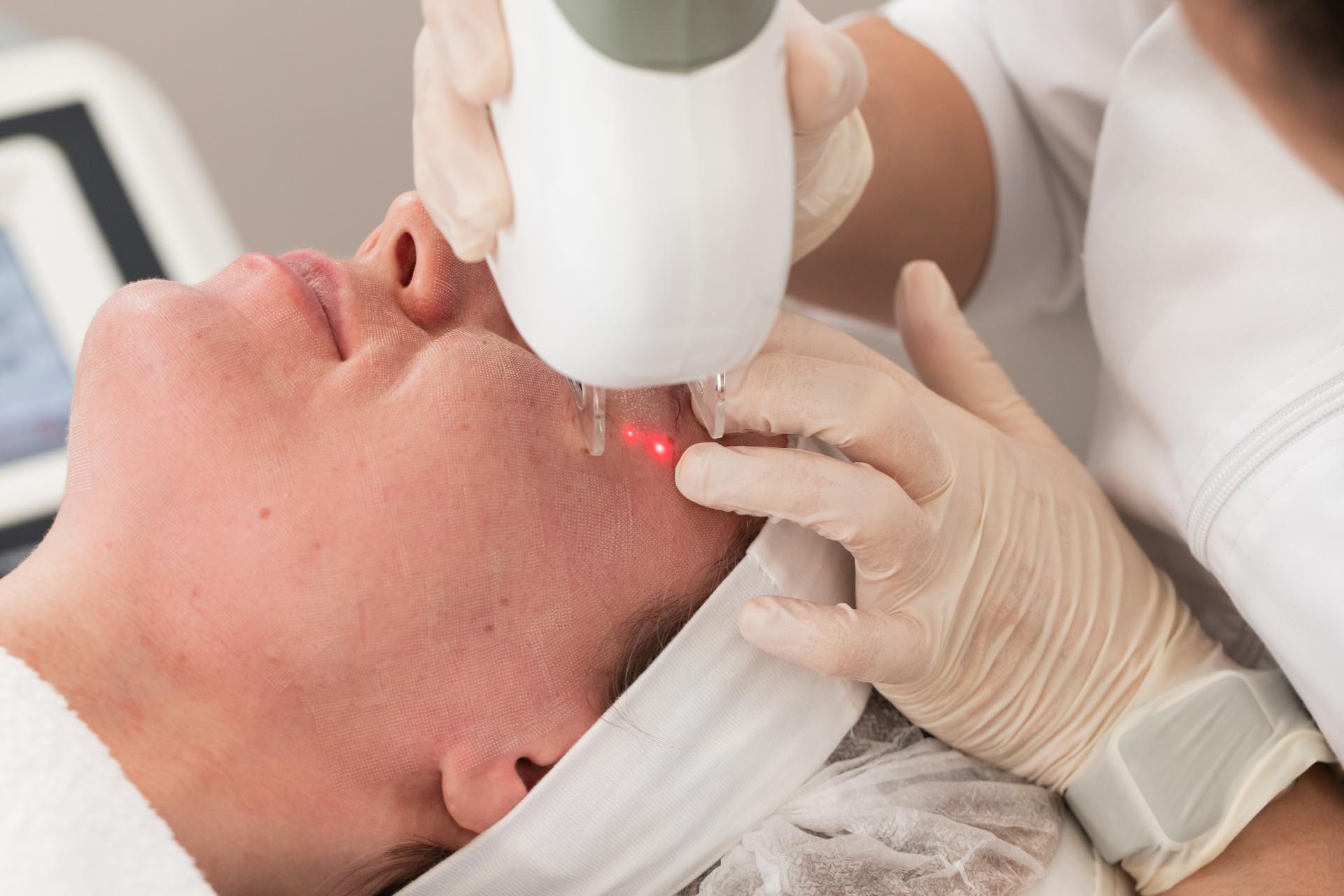 Which Laser Is Right For You? A Guide To Lasers - Emil A. Tanghetti, MD