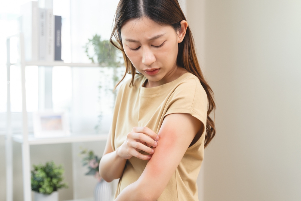 Is Eczema Contagious? Real Facts and Remedies for This Common Condition