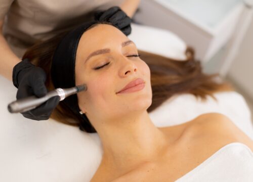 Microneedling: Why This Tiny Treatment Packs a Big Punch