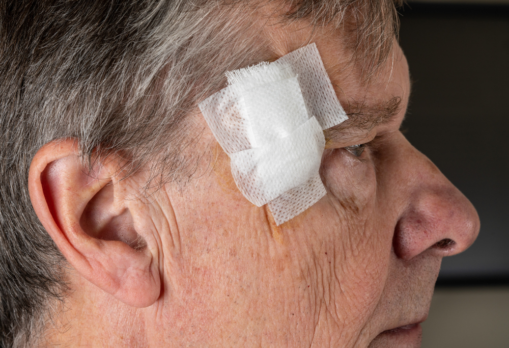 How Mohs Surgery Works to Effectively Treat Skin Cancer