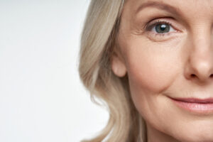 Collagen