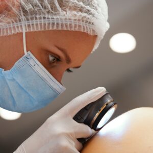 Is Melanoma Genetic?