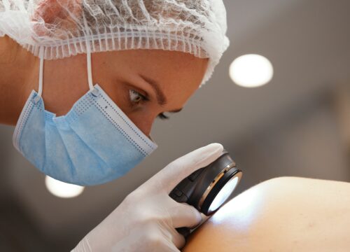 Is Melanoma Genetic?