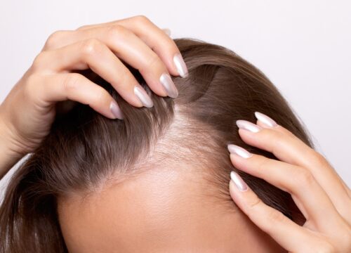 8 Signs You Should See a Dermatologist About Hair Loss