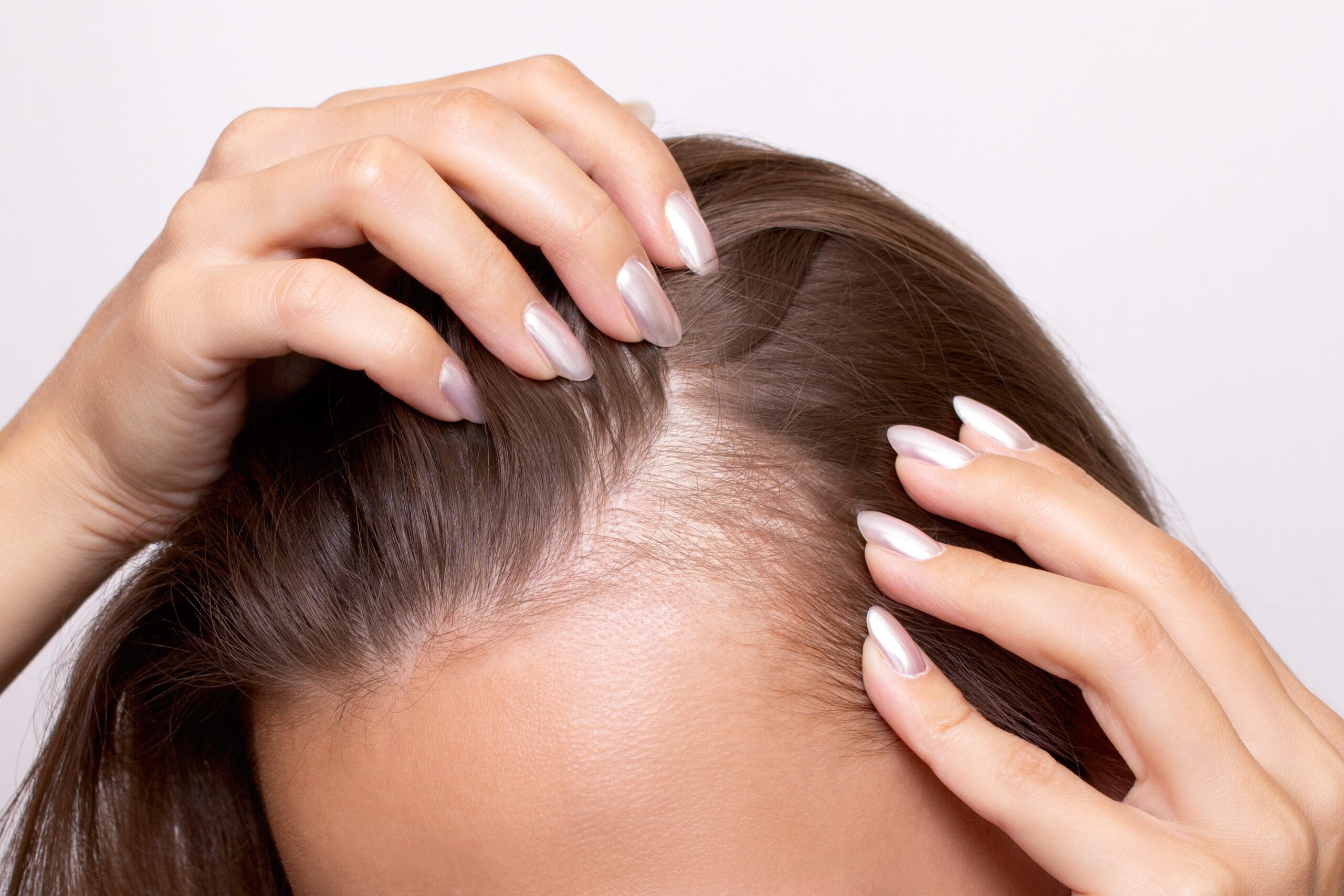8 Signs You Should See a Dermatologist About Hair Loss