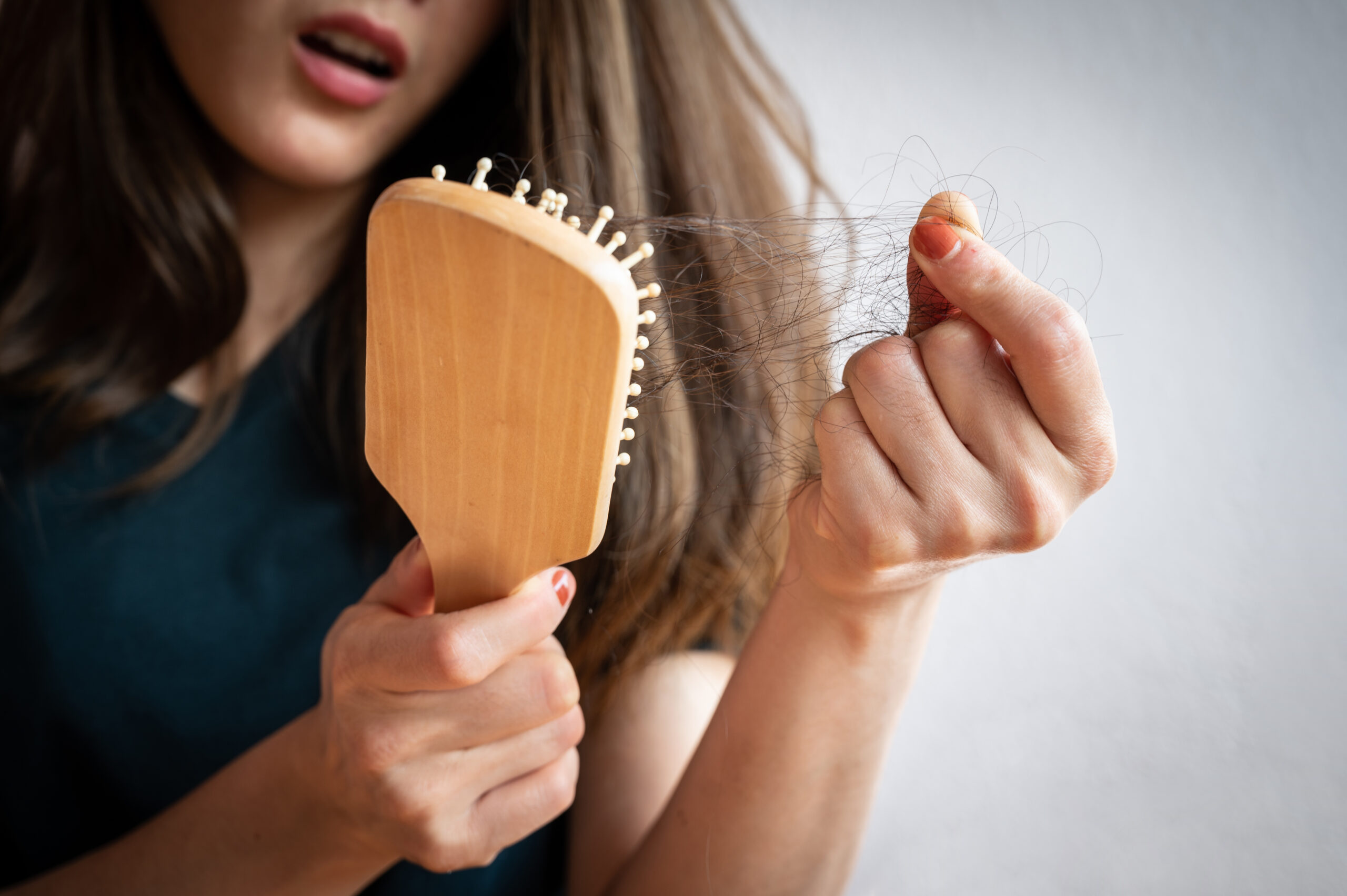 What Really Causes Menopausal Hair Loss and How to Address It