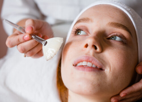 8 Things to Remember When Healing From a Chemical Peel