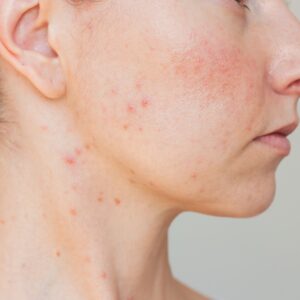 Top 8 Most Common Skin Conditions and Their Treatments