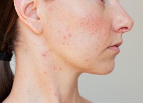 Top 8 Most Common Skin Conditions and Their Treatments