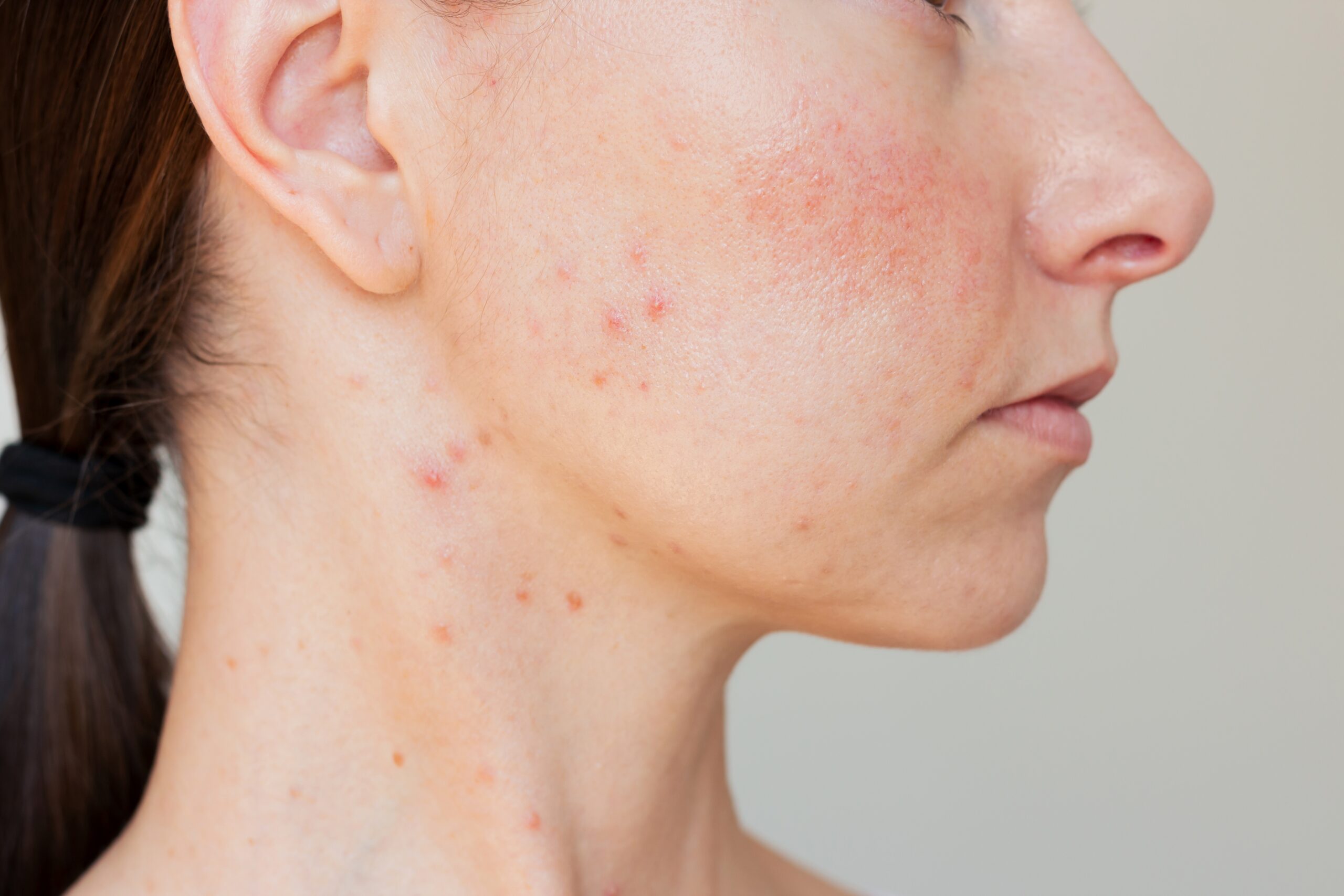 Top 8 Most Common Skin Conditions and Their Treatments