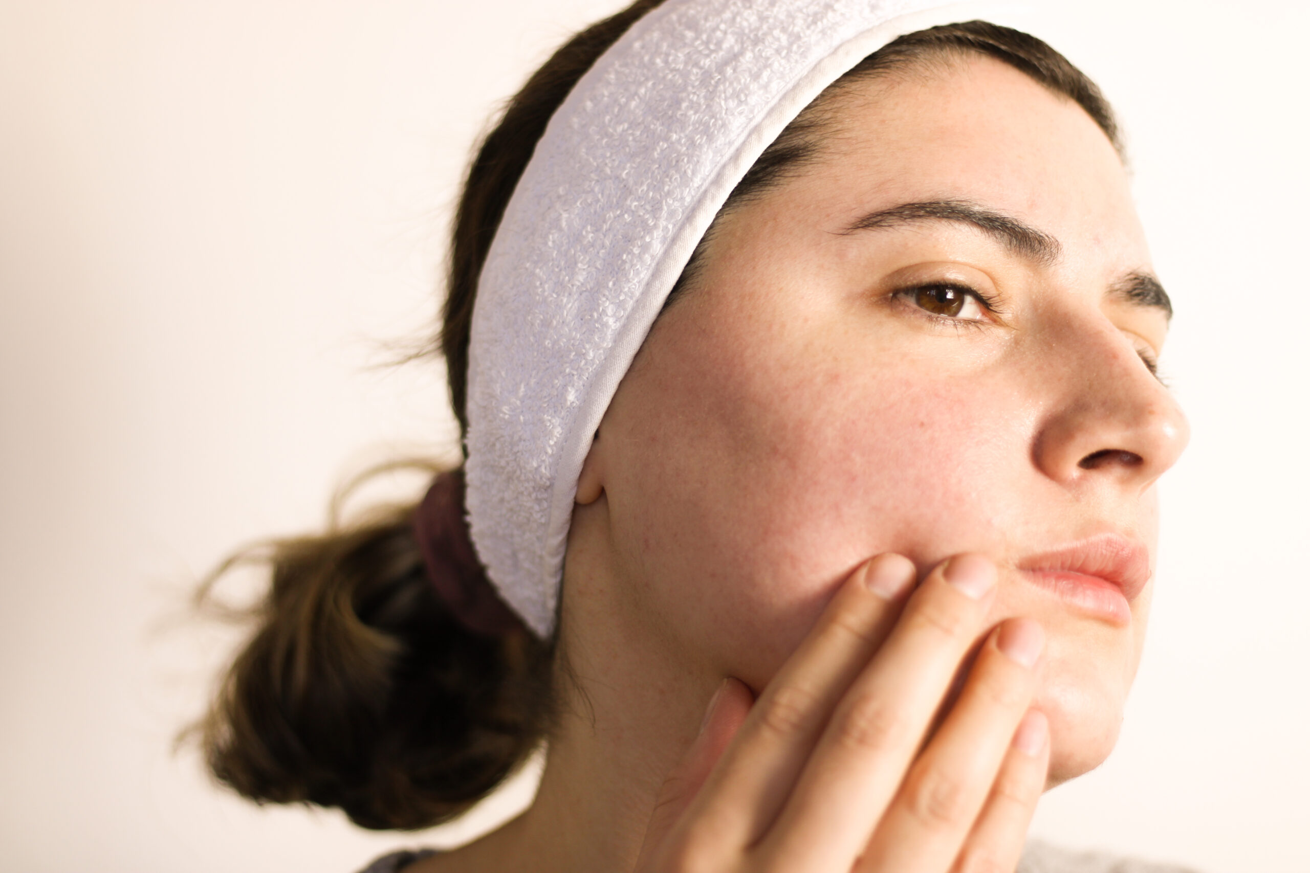 What Is the Difference Between Rosacea and Regular Sensitive Skin?
