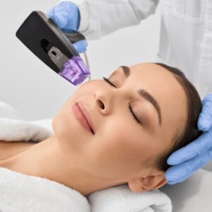 Why Professional RF Microneedling Beats At-Home Devices Every Time