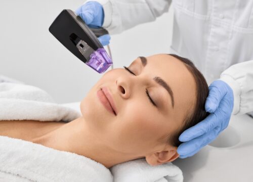 Why Professional RF Microneedling Beats At-Home Devices Every Time