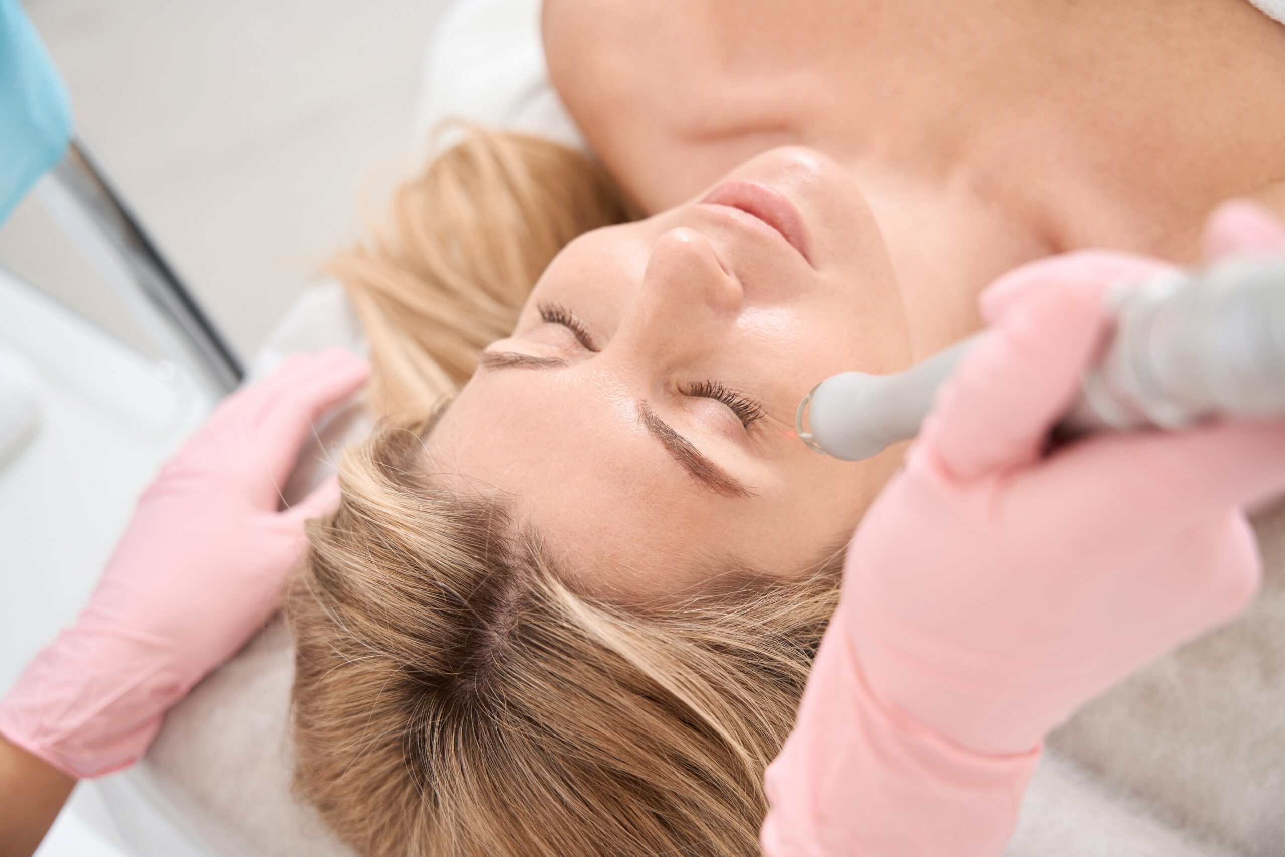 6 Myths About Laser Skin Resurfacing