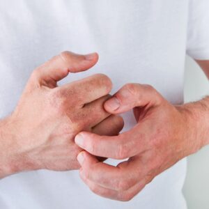 How Do You Know if You Need Systemic Medications for Psoriasis?