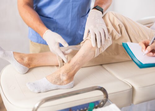 5 Signs You Need to See a Vein Specialist This Year