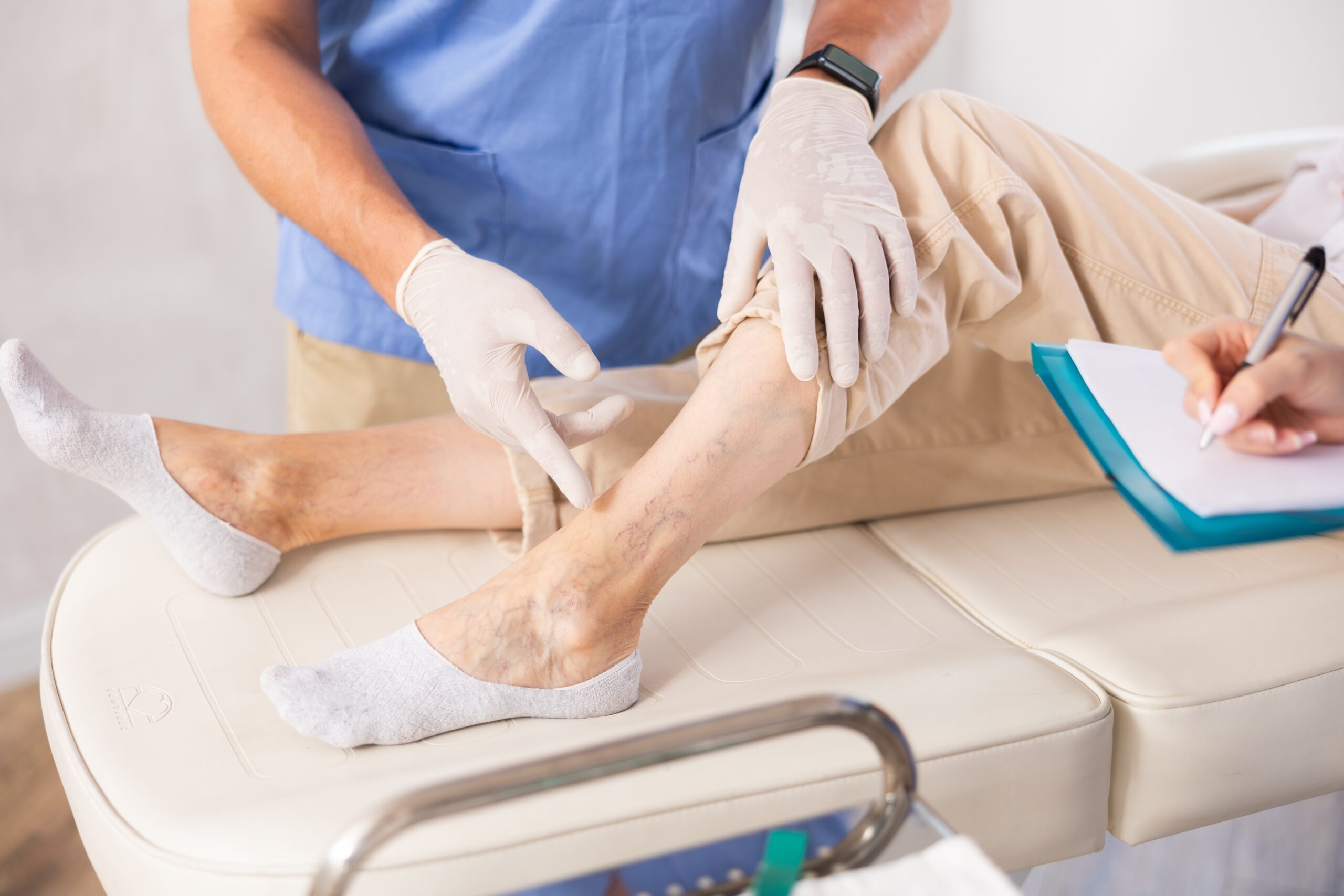 5 Signs You Need to See a Vein Specialist This Year