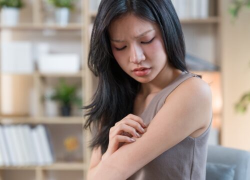 How Can You Break the Itch-Scratch Cycle of Chronic Dermatitis?