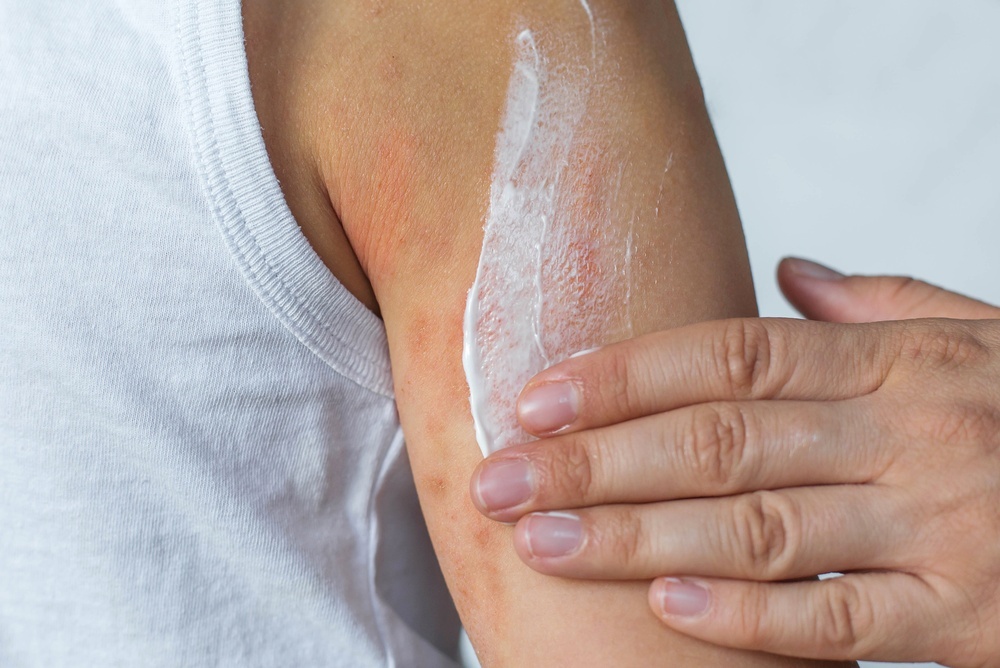 Close-up of a person applying cream