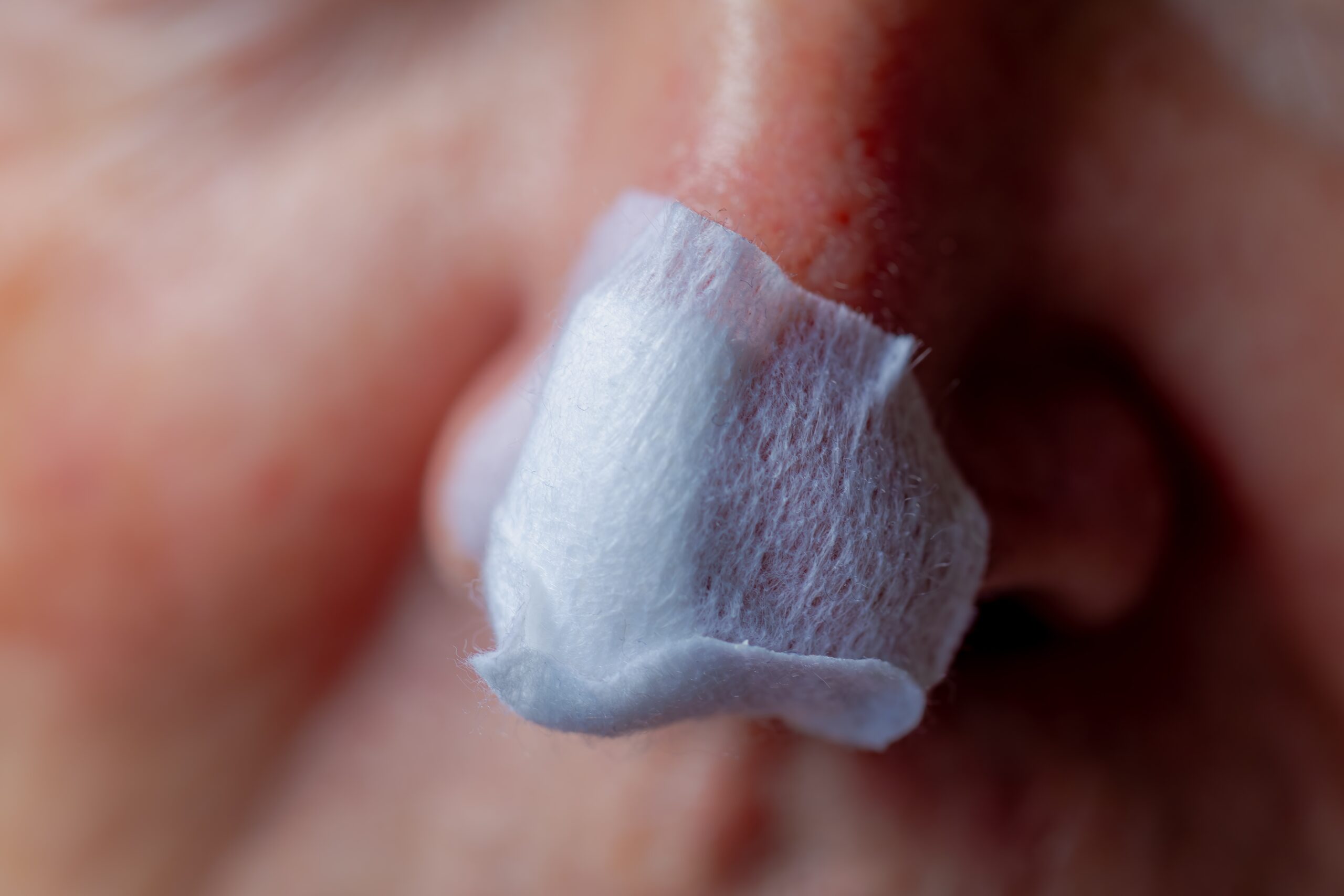 Can You Speed Up Healing After Mohs?